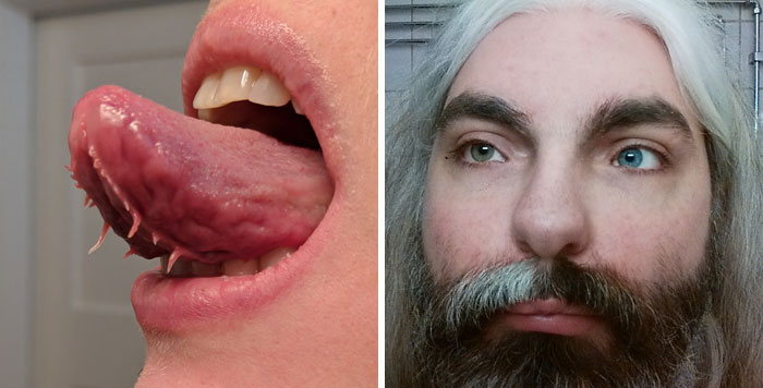 30 Personas cuya genética les hace únicos