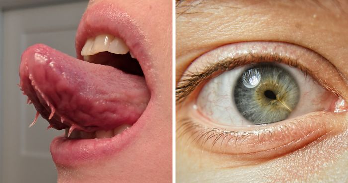 30 People Whose Genetics Made Them Unique30 People Whose Genetics Made Them Unique