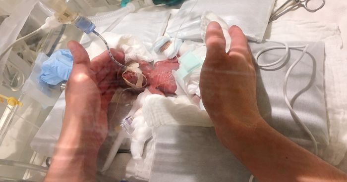 After Spending Months In The Hospital, The World’s Smallest Surviving Premature Baby Has Been Finally Sent Home
