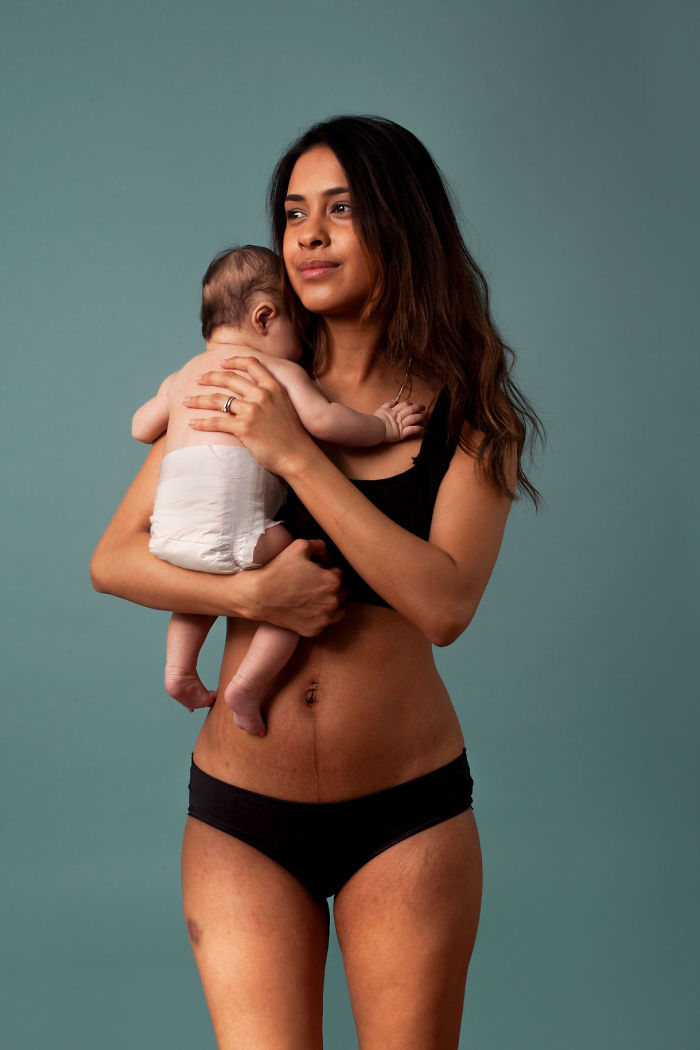 This Campaign Celebrates Postpartum Bodies To End Unrealistic Expectations For New Moms This Campaign Celebrates Postpartum Bodies To End Unrealistic Expectations For New Moms