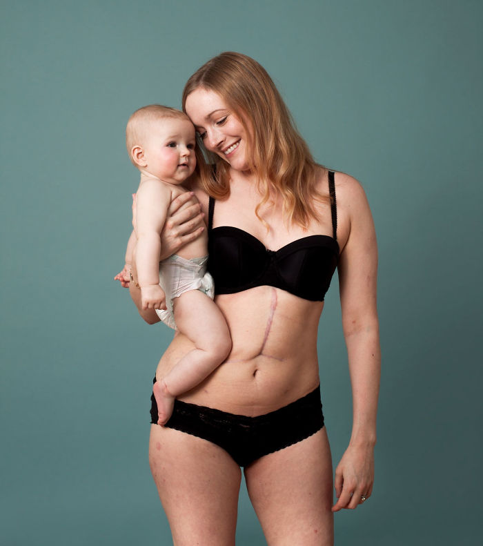 This Campaign Celebrates Postpartum Bodies To End Unrealistic Expectations For New Moms This Campaign Celebrates Postpartum Bodies To End Unrealistic Expectations For New Moms