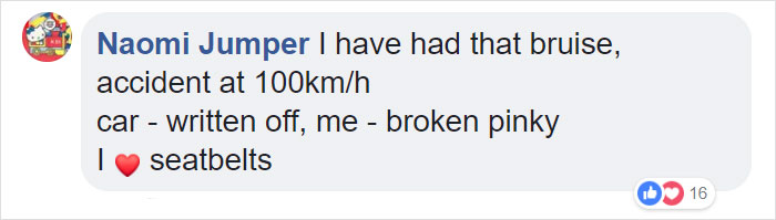 10 Car Crash Survivors Pose Proudly For A Chilling Photo Project To Raise Awareness About Seatbelt Safety 10 Car Crash Survivors Pose Proudly For A Chilling Photo Project To Raise Awareness About Seatbelt Safety