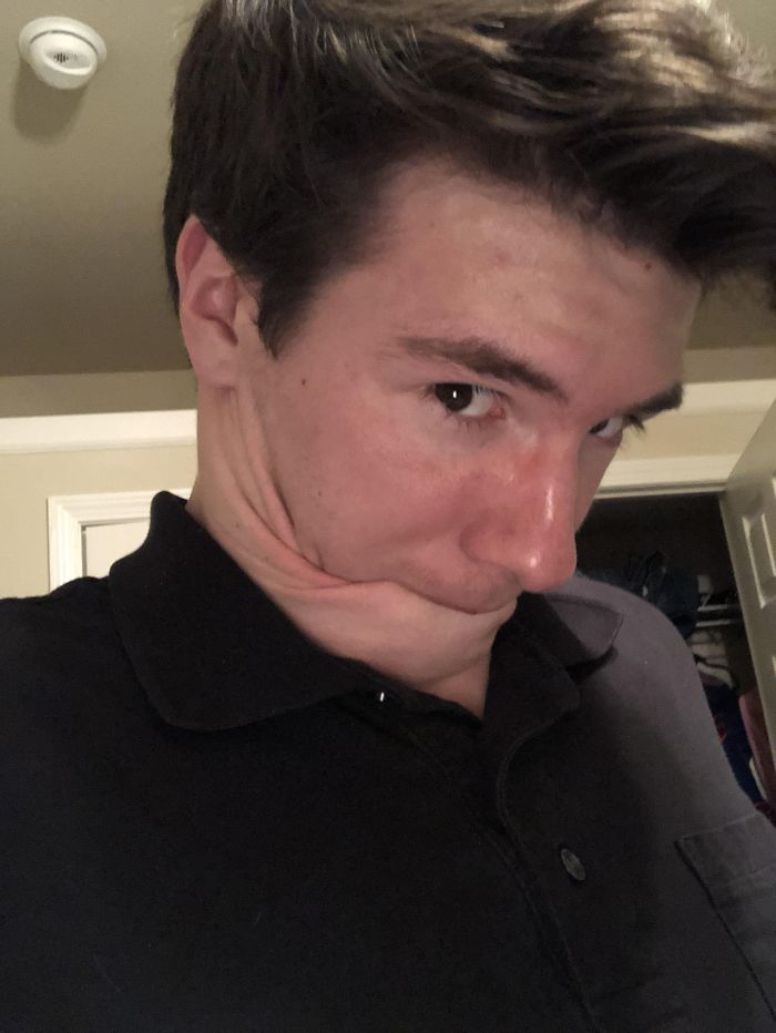 My Neck Skin Is Stretchy Enough To Allow Me To Suck On It With No Hands