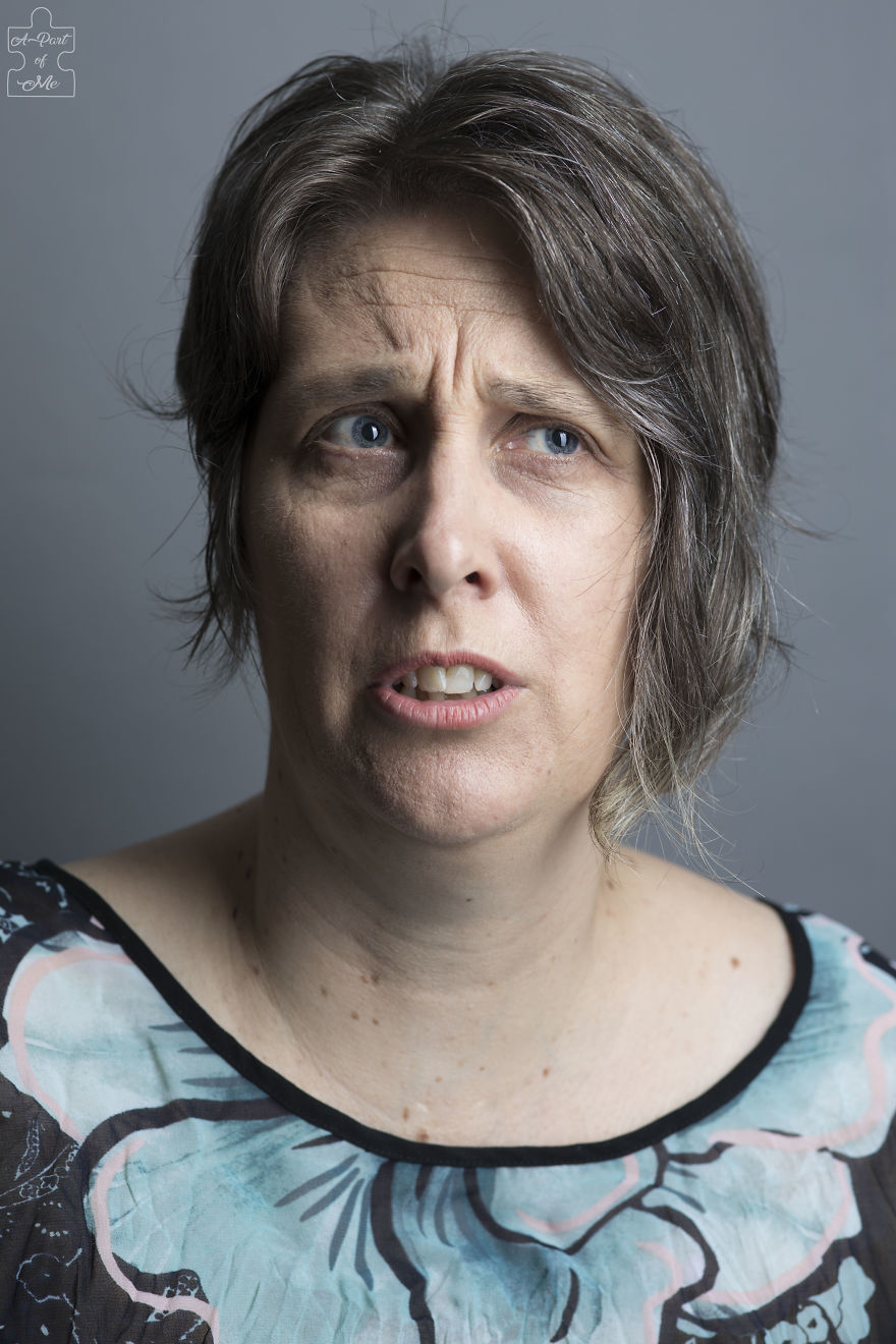 Faces And Stories Of People With Mental Or Physical Illnesses: 16 Portraits I Took