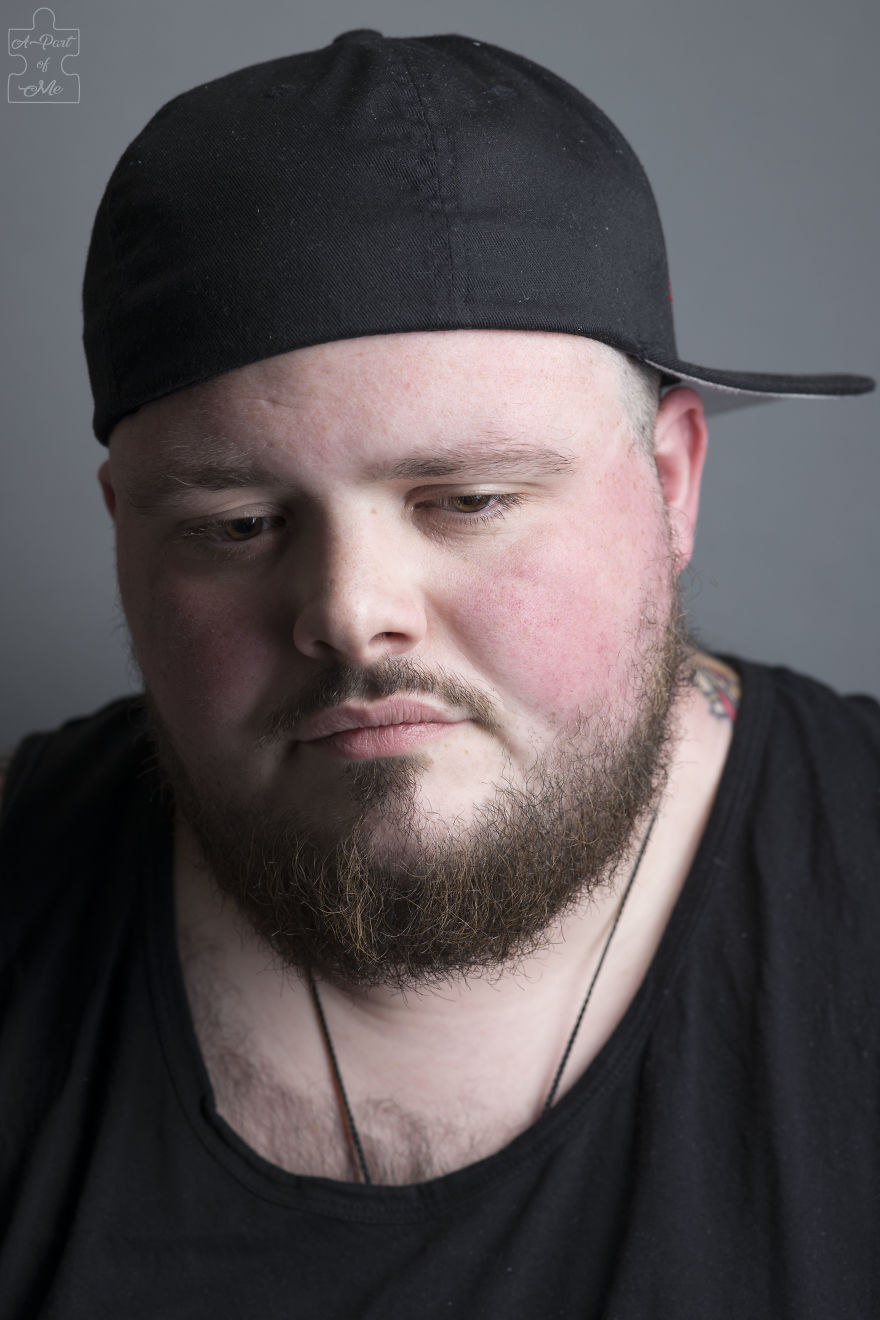 Faces And Stories Of People With Mental Or Physical Illnesses: 16 Portraits I Took Faces And Stories Of People With Mental Or Physical Illnesses: 16 Portraits I Took