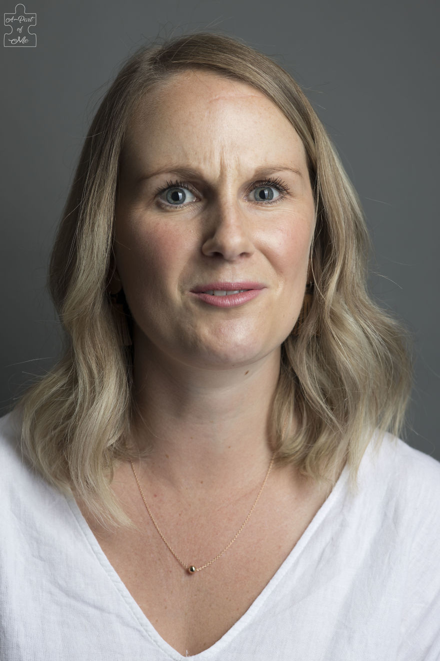 Faces And Stories Of People With Mental Or Physical Illnesses: 16 Portraits I Took