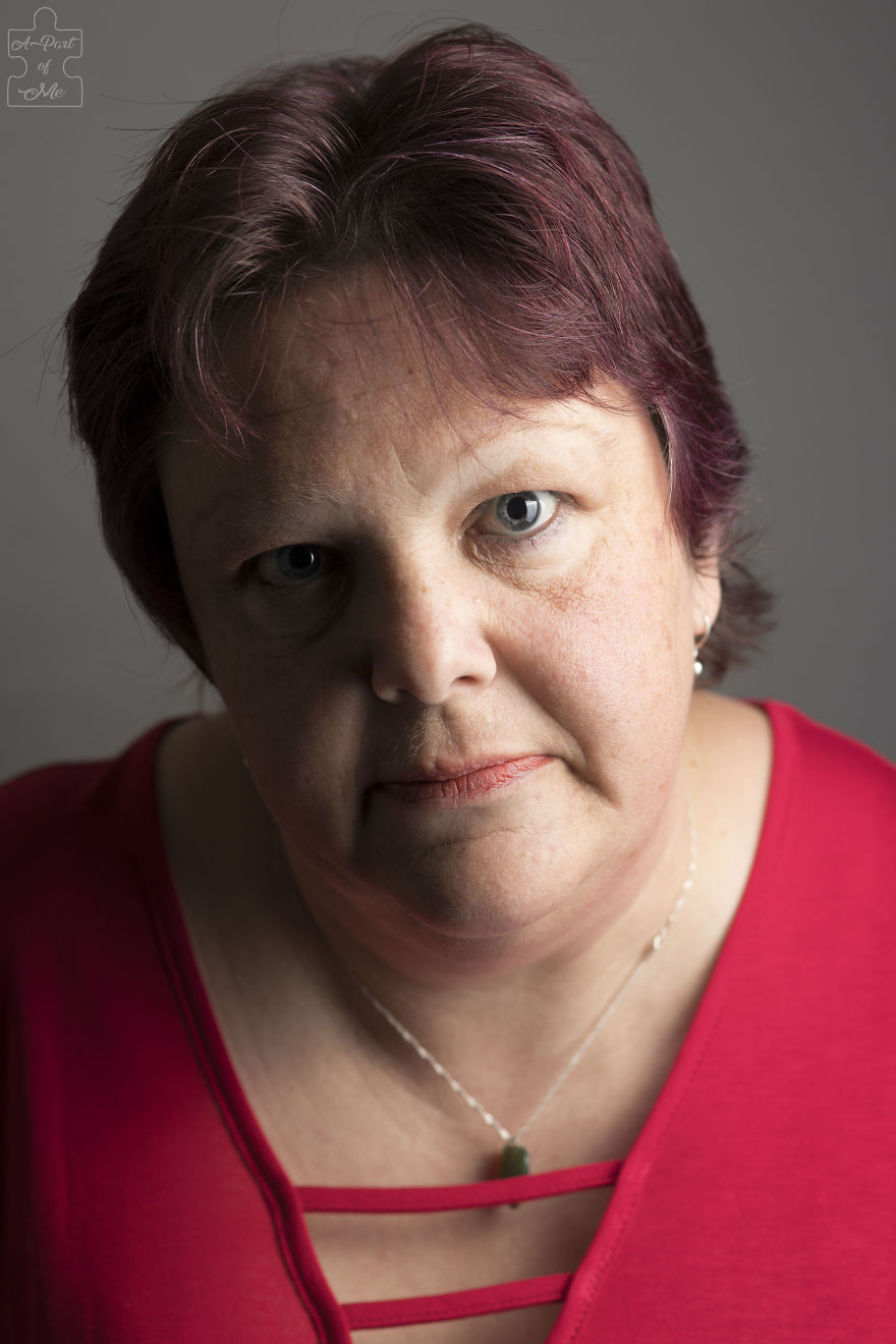 Faces And Stories Of People With Mental Or Physical Illnesses: 16 Portraits I Took