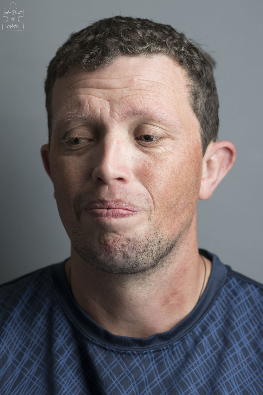 Faces And Stories Of People With Mental Or Physical Illnesses: 16 Portraits I Took Faces And Stories Of People With Mental Or Physical Illnesses: 16 Portraits I Took