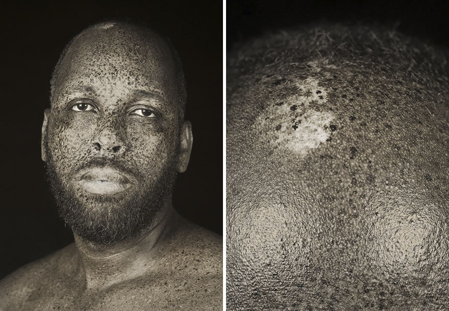 Artist Uses UV Photography Techniques To Reveal 'Raw' Portraits Of People That We Don't Normally See (10 Pics) Artist Uses UV Photography Techniques To Reveal 'Raw' Portraits Of People That We Don't Normally See (10 Pics)