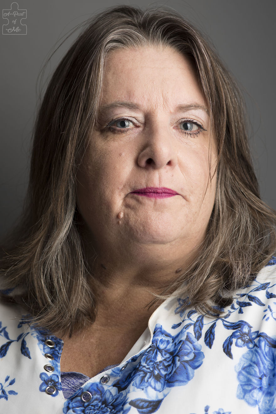 Faces And Stories Of People With Mental Or Physical Illnesses: 16 Portraits I Took