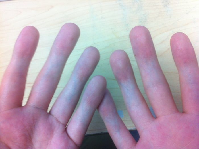 People Can't Understand How This Guy Took A Photo Of Both Of His Hands, He Explains It With Even More 'Unexplainable' Pictures People Can't Understand How This Guy Took A Photo Of Both Of His Hands, He Explains It With Even More 'Unexplainable' Pictures