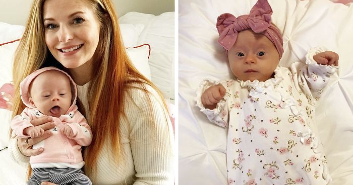 Mom Shares Honest ‘Review’ Of Her Baby With Down Syndrome, And 347K People Love It