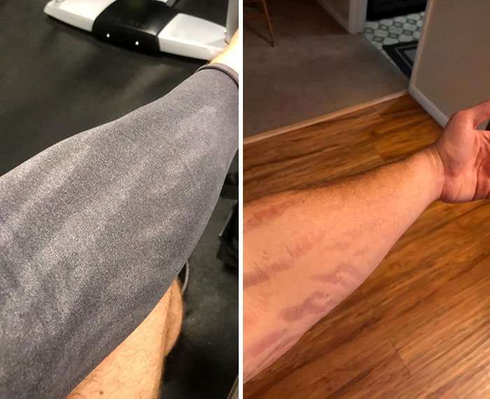 My Scars Don't Seem To Sweat