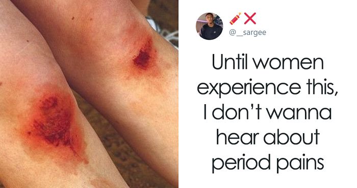 Man Says Women Should Stop Complaining About Period Pain Unless They Know What A Scraped Knee Pain Feels Like, Gets Shut Down