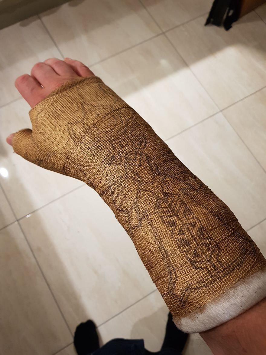 After Breaking My Wrist, I Turned My Plain Cast Into Thanos‘ Infinity Gauntlet