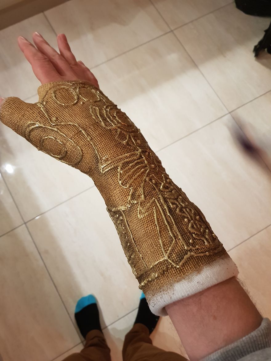 After Breaking My Wrist, I Turned My Plain Cast Into Thanos‘ Infinity Gauntlet