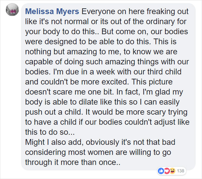 This 'Dilation Chart' Helps People Understand That Giving Birth Is Not Just Painful, It's Hardcore