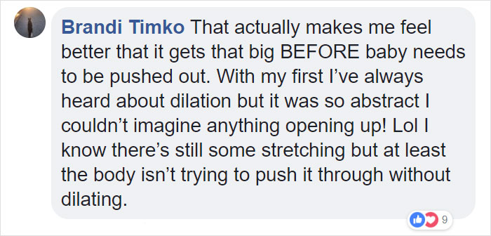 This 'Dilation Chart' Helps People Understand That Giving Birth Is Not Just Painful, It's Hardcore This 'Dilation Chart' Helps People Understand That Giving Birth Is Not Just Painful, It's Hardcore