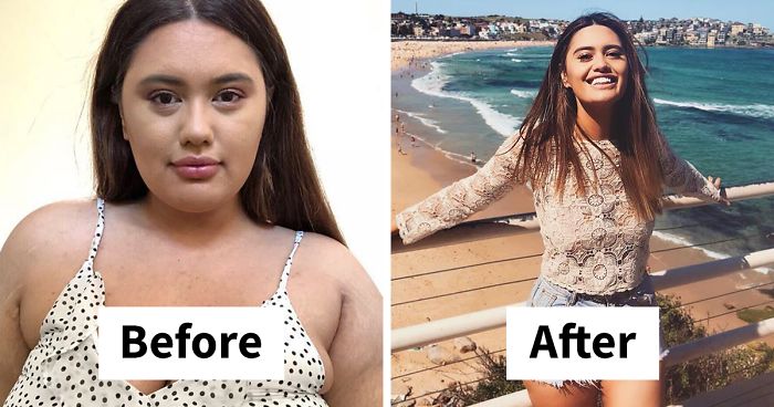 Woman Reveals Before-And-After Pictures Of Her 141-Pound Weight Loss, And She’s Completely Transparent About It