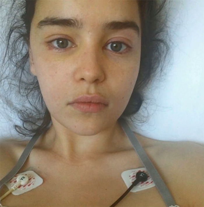 Emilia Clarke Shares 5 Never-Before-Seen Photos From Hospital After Having Two Aneurysms Emilia Clarke Shares 5 Never-Before-Seen Photos From Hospital After Having Two Aneurysms