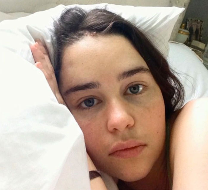Emilia Clarke Shares 5 Never-Before-Seen Photos From Hospital After Having Two Aneurysms Emilia Clarke Shares 5 Never-Before-Seen Photos From Hospital After Having Two Aneurysms