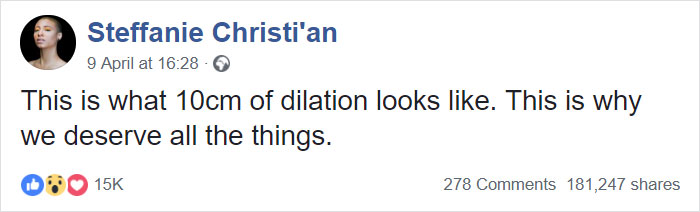 This 'Dilation Chart' Helps People Understand That Giving Birth Is Not Just Painful, It's Hardcore This 'Dilation Chart' Helps People Understand That Giving Birth Is Not Just Painful, It's Hardcore