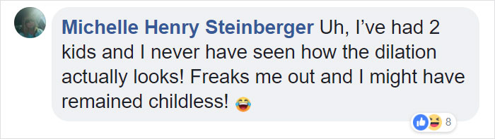 This 'Dilation Chart' Helps People Understand That Giving Birth Is Not Just Painful, It's Hardcore This 'Dilation Chart' Helps People Understand That Giving Birth Is Not Just Painful, It's Hardcore