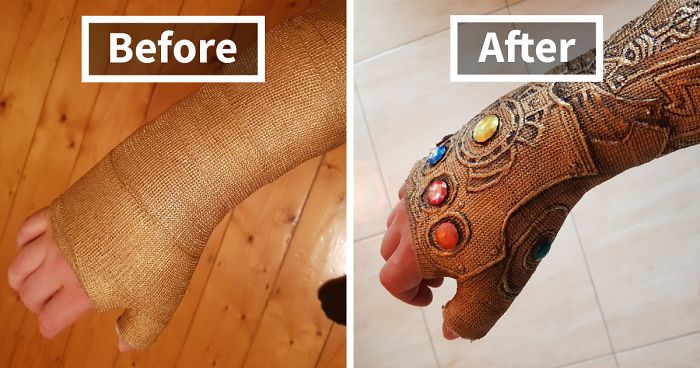 After Breaking My Wrist, I Turned My Plain Cast Into Thanos‘ Infinity Gauntlet