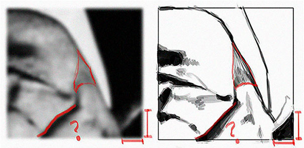 Artist Points Out The Mistakes Beginner Artists Make Because They Draw With Their Brain, Not Their Eyes Artist Points Out The Mistakes Beginner Artists Make Because They Draw With Their Brain, Not Their Eyes