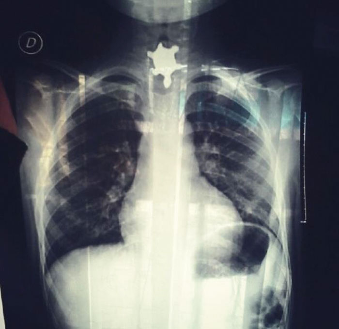 30 Dumbest Ways People Managed To Get Injured