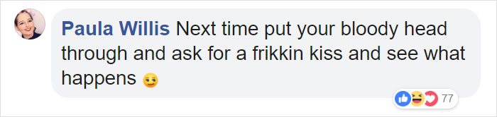 Man Thinks He's Special Enough To Pet A Lion, Ends Up With A Severe Injury