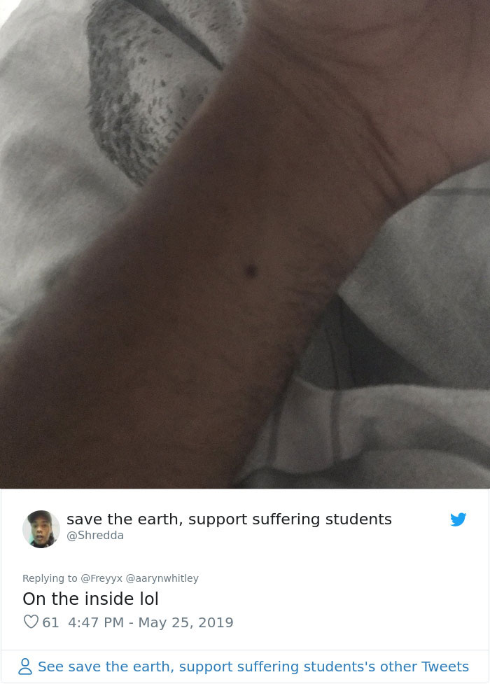 Someone Claims All Women Have A Freckle In The Middle Of Their Wrists, And People Start Freaking Out (23 Pics) Someone Claims All Women Have A Freckle In The Middle Of Their Wrists, And People Start Freaking Out (23 Pics)