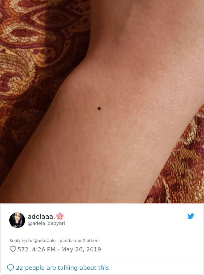 Someone Claims All Women Have A Freckle In The Middle Of Their Wrists, And People Start Freaking Out (23 Pics) Someone Claims All Women Have A Freckle In The Middle Of Their Wrists, And People Start Freaking Out (23 Pics)