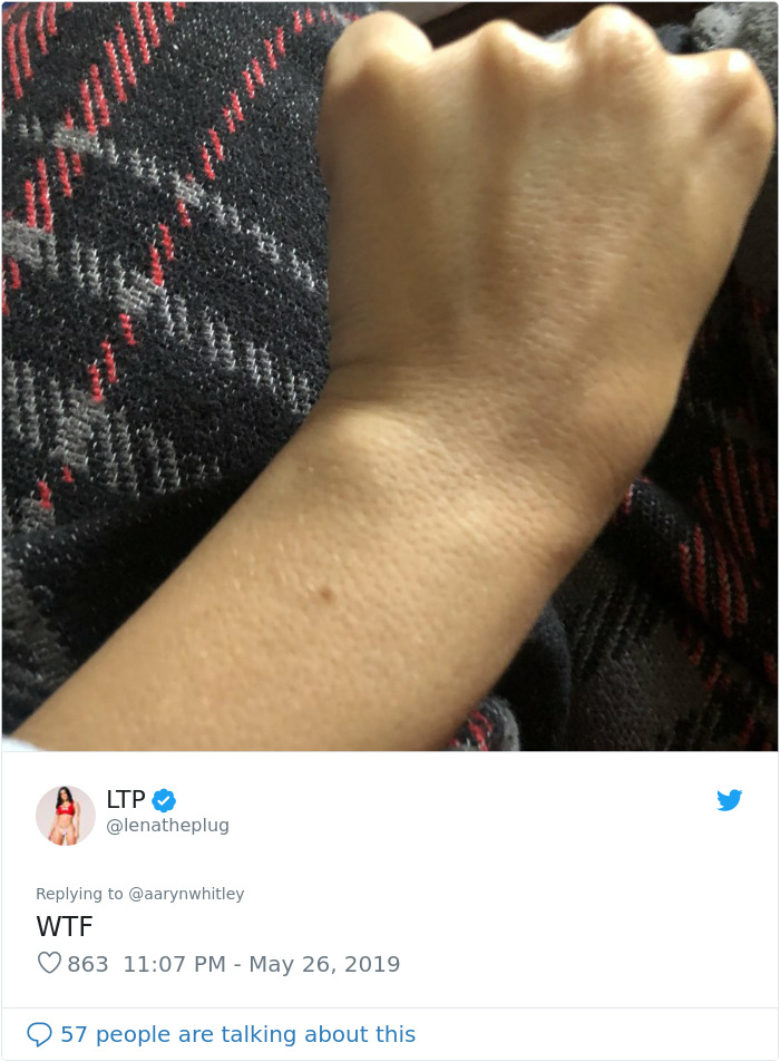 Someone Claims All Women Have A Freckle In The Middle Of Their Wrists, And People Start Freaking Out (23 Pics) Someone Claims All Women Have A Freckle In The Middle Of Their Wrists, And People Start Freaking Out (23 Pics)