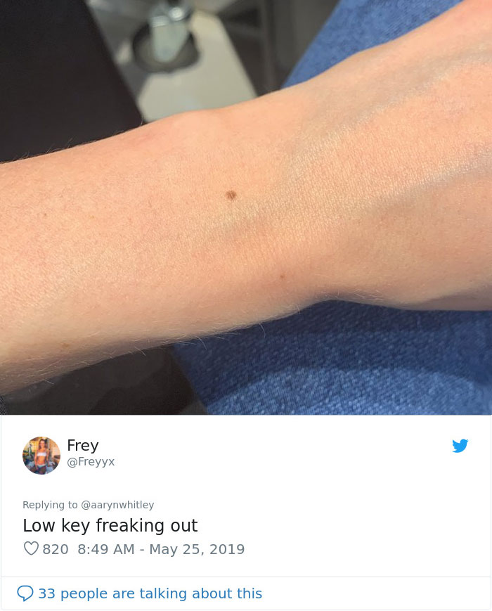 Someone Claims All Women Have A Freckle In The Middle Of Their Wrists, And People Start Freaking Out (23 Pics) Someone Claims All Women Have A Freckle In The Middle Of Their Wrists, And People Start Freaking Out (23 Pics)