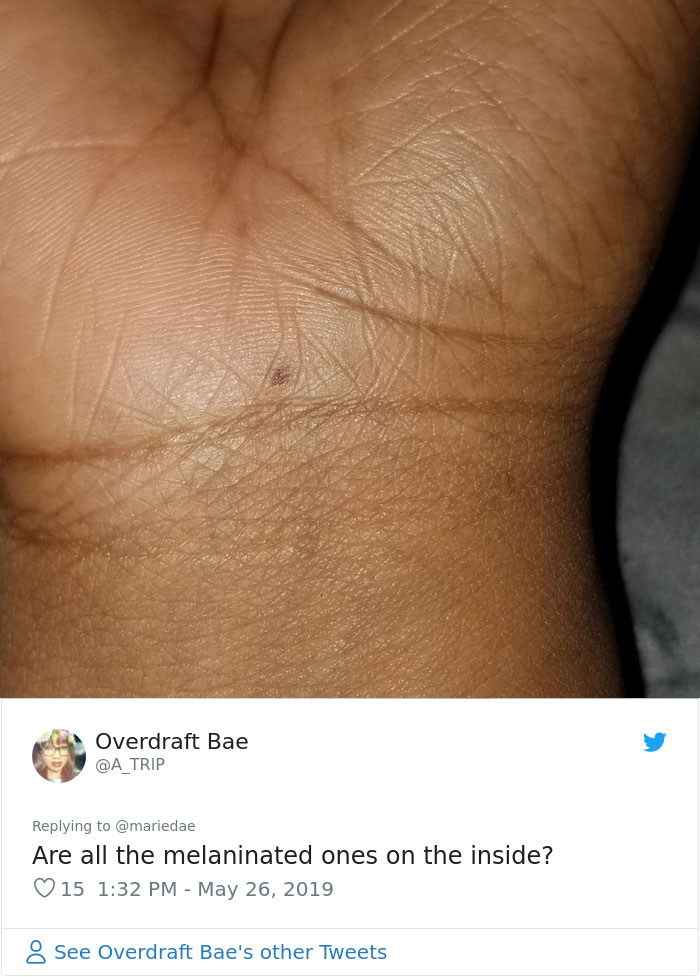 Someone Claims All Women Have A Freckle In The Middle Of Their Wrists, And People Start Freaking Out (23 Pics) Someone Claims All Women Have A Freckle In The Middle Of Their Wrists, And People Start Freaking Out (23 Pics)