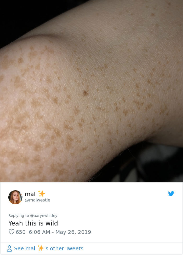 Someone Claims All Women Have A Freckle In The Middle Of Their Wrists, And People Start Freaking Out (23 Pics) Someone Claims All Women Have A Freckle In The Middle Of Their Wrists, And People Start Freaking Out (23 Pics)