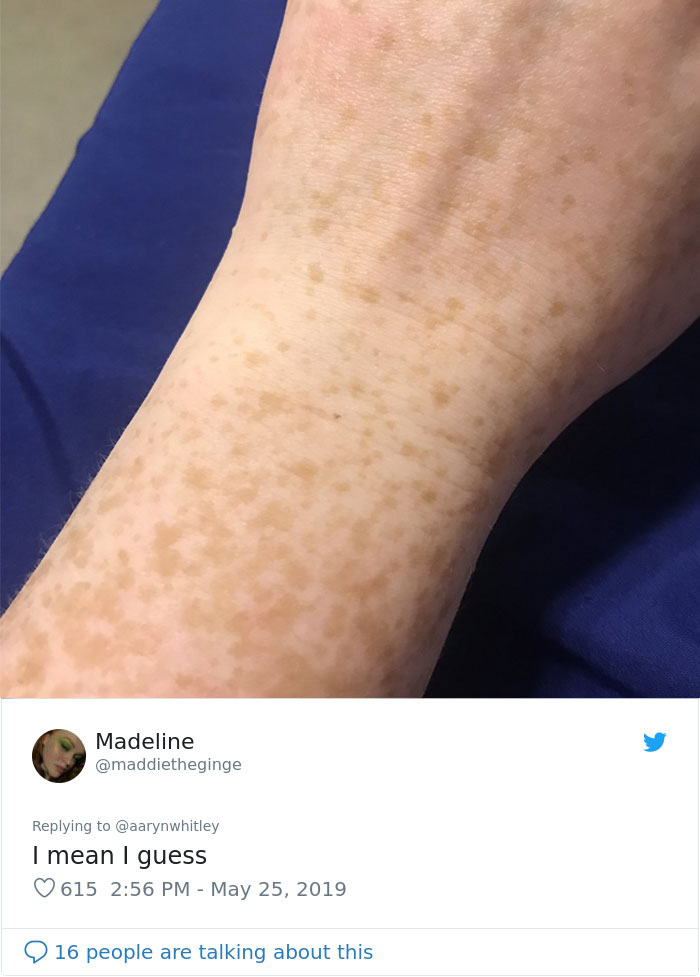 Someone Claims All Women Have A Freckle In The Middle Of Their Wrists, And People Start Freaking Out (23 Pics) Someone Claims All Women Have A Freckle In The Middle Of Their Wrists, And People Start Freaking Out (23 Pics)