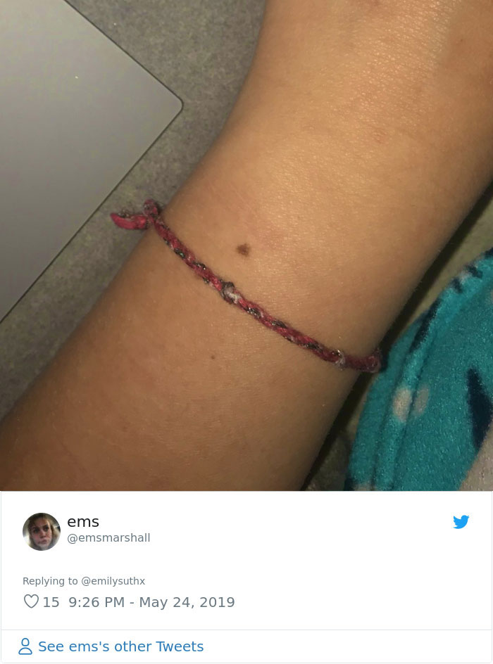 Someone Claims All Women Have A Freckle In The Middle Of Their Wrists, And People Start Freaking Out (23 Pics) Someone Claims All Women Have A Freckle In The Middle Of Their Wrists, And People Start Freaking Out (23 Pics)