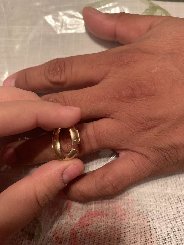 My Dads Wedding Ring Has Been Stuck On His Finger For The Past 21 Years. Today It Finally Broke