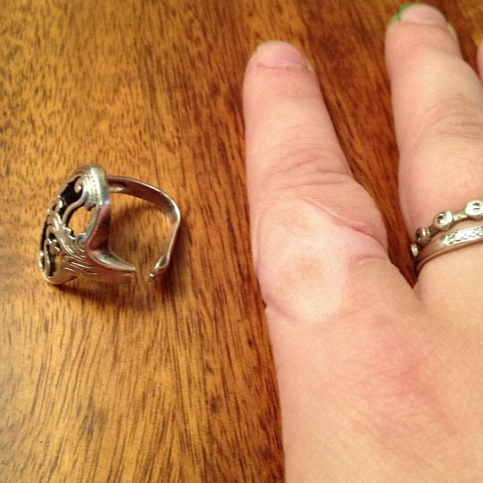 My Friend Just Cut A Ring Off Her Finger That She Wore For 9 Years