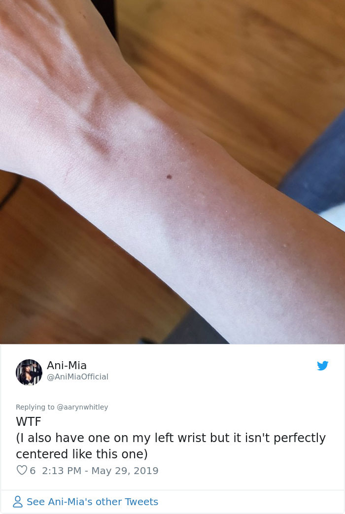 Someone Claims All Women Have A Freckle In The Middle Of Their Wrists, And People Start Freaking Out (23 Pics) Someone Claims All Women Have A Freckle In The Middle Of Their Wrists, And People Start Freaking Out (23 Pics)