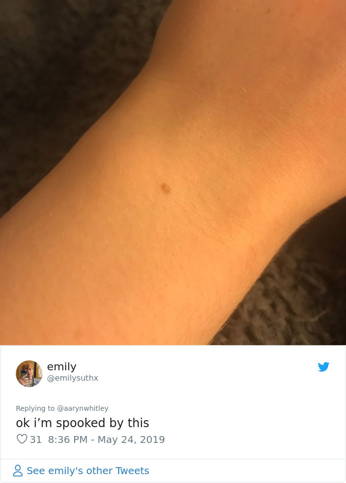 Someone Claims All Women Have A Freckle In The Middle Of Their Wrists, And People Start Freaking Out (23 Pics) Someone Claims All Women Have A Freckle In The Middle Of Their Wrists, And People Start Freaking Out (23 Pics)