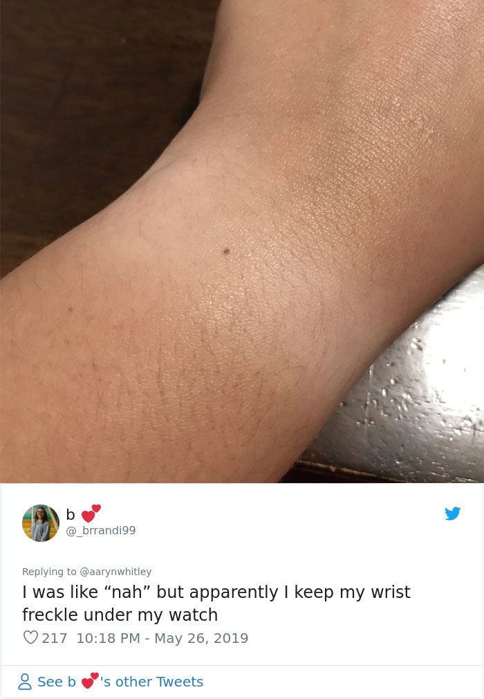 Someone Claims All Women Have A Freckle In The Middle Of Their Wrists, And People Start Freaking Out (23 Pics) Someone Claims All Women Have A Freckle In The Middle Of Their Wrists, And People Start Freaking Out (23 Pics)