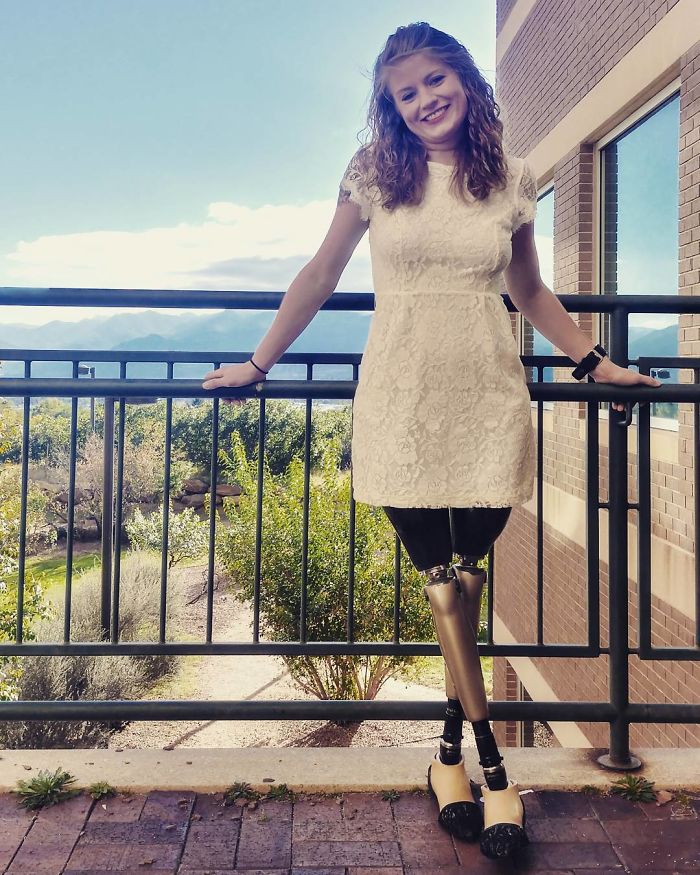 This Woman Lost Both Of Her Legs But Not Her Dark Sense Of Humor, Shows It Off On Tinder