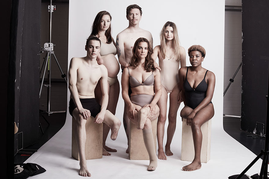 We Photographed 19 People With Limb Differences Aged From 2 To 54 In Body Confidence Shoot We Photographed 19 People With Limb Differences Aged From 2 To 54 In Body Confidence Shoot