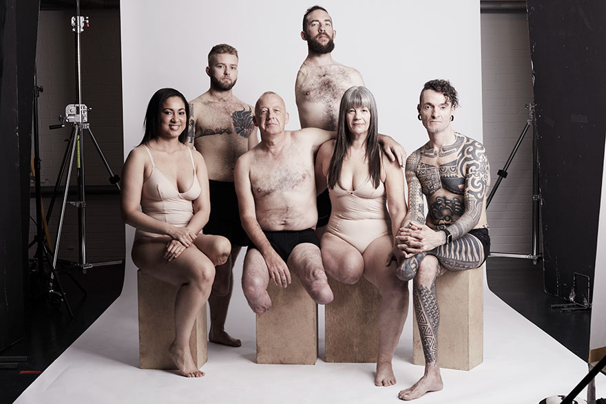 We Photographed 19 People With Limb Differences Aged From 2 To 54 In Body Confidence Shoot