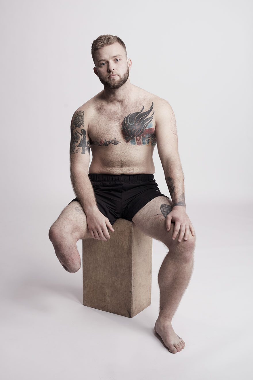 We Photographed 19 People With Limb Differences Aged From 2 To 54 In Body Confidence Shoot