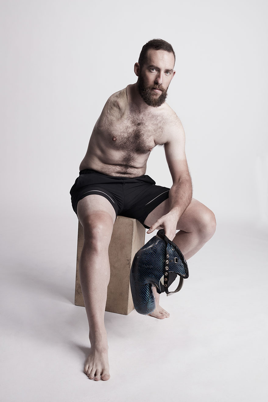 We Photographed 19 People With Limb Differences Aged From 2 To 54 In Body Confidence Shoot We Photographed 19 People With Limb Differences Aged From 2 To 54 In Body Confidence Shoot