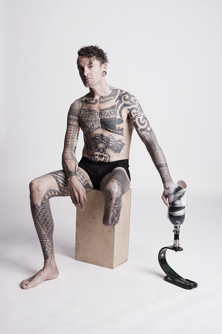 We Photographed 19 People With Limb Differences Aged From 2 To 54 In Body Confidence Shoot We Photographed 19 People With Limb Differences Aged From 2 To 54 In Body Confidence Shoot